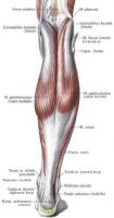 Chirurgie du tendon d'Achille à Annecy